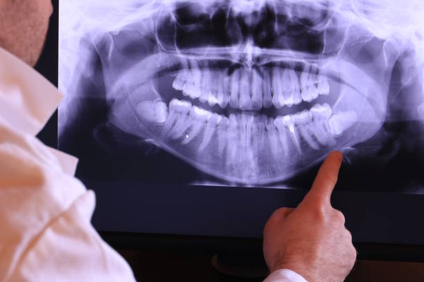 Best Broken Tooth Emergency  in Queen Anne, MD